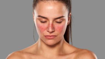 "Nuestros resultados muestran unas diferencias muy notables en la expresión génica entre las mujeres y los varones."