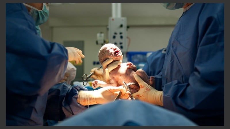 Los casos en los que el bebé no cabe en el canal de parto aumentaron de 30 en 1000 en los años ‘60 a 36 en 1000 en la actualidad.