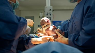 Los casos en los que el bebé no cabe en el canal de parto aumentaron de 30 en 1000 en los años ‘60 a 36 en 1000 en la actualidad.