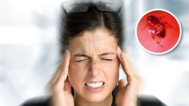 La cucaracha que originó el dolor de cabeza en la mujer