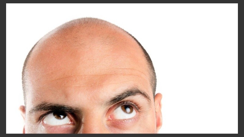 Los investigadores crearon una fórmula para tratar de anticipar los riesgos de un hombre de volverse calvo.