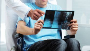 El próximo paso será comparar la eficacia del procedimiento frente al placebo.