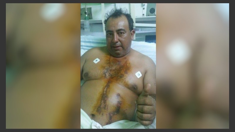 Adrián Pérez fue internado en el Hospital de Resistencia.