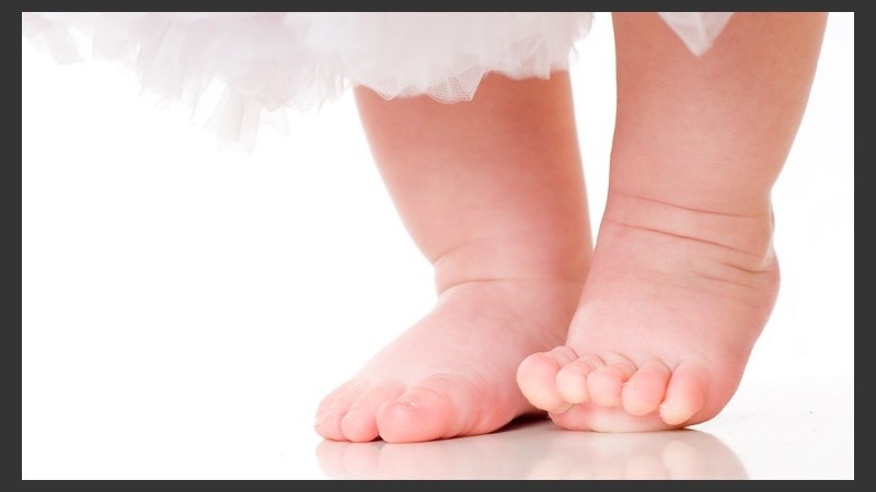 El pie plano se presenta muchas veces acompañado de otra afección.