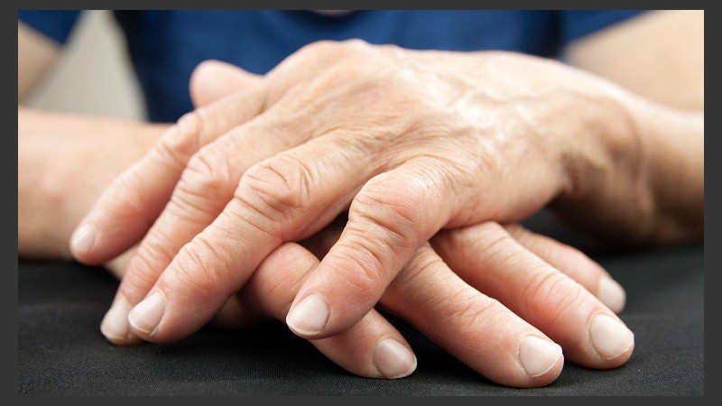 Todavía se desconoce el origen de la artritis reumatoide, pero ahora se sabe una forma de prevenirla.