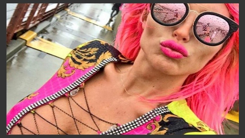 Xipolitakis no para de llamar la atención. 