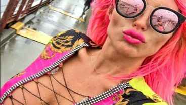 Xipolitakis no para de llamar la atención.