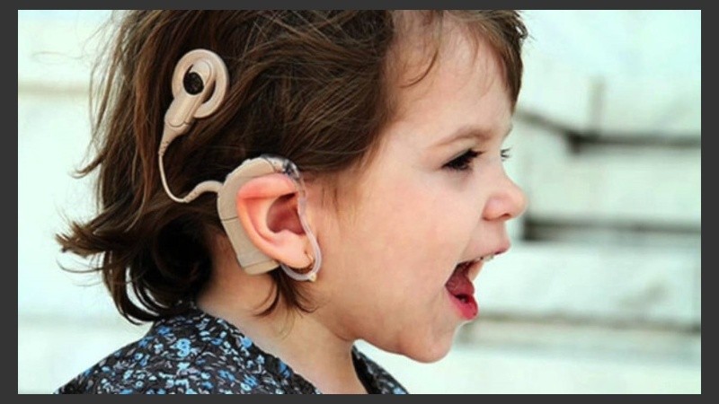 Cientos de miles de pacientes hipoacúsicos en todo el mundo se han beneficiado con este adelanto.