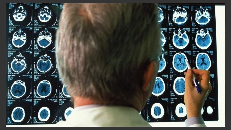 Según la Organización Mundial de la Salud, en el mundo hay 47,5 millones de personas con demencia