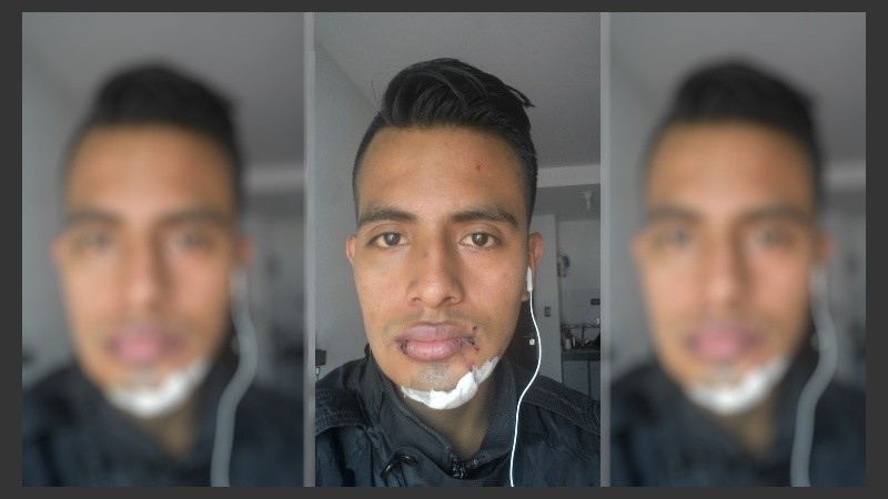 Así quedó el rostro del joven agredido.