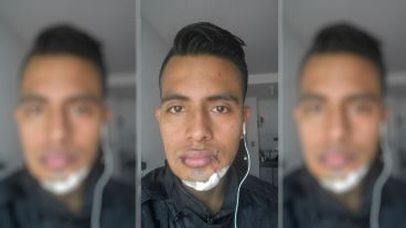 Así quedó el rostro del joven agredido.