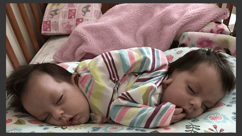 Las siamesas no será separadas por consejo médico.