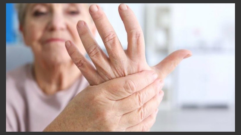 La artritis  es una enfermedad autoinmunitaria que se caracteriza por hinchazón y rigidez matutina de las articulaciones.