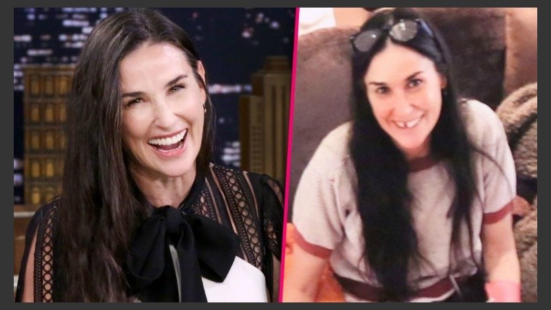 En el show de Jimmy Fallon, Demi Moore se rió de su foto sin un diente.