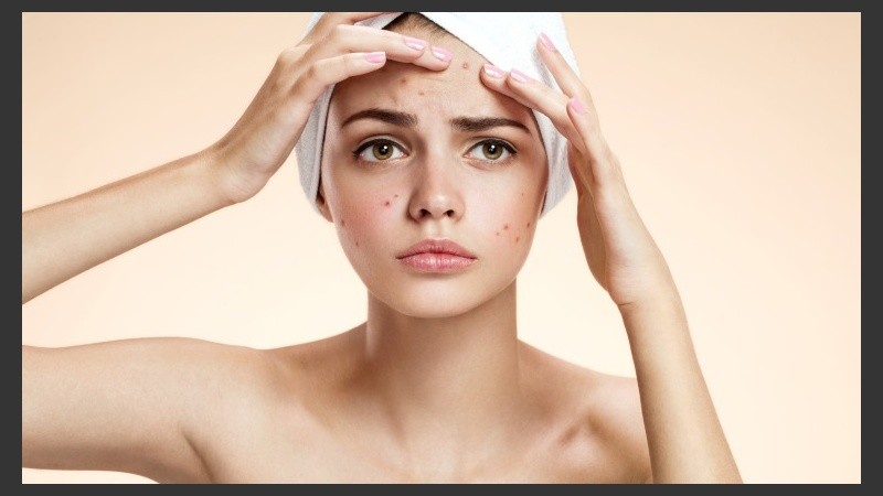 Para cuidarse del acné, se debe realizar una limpieza adecuada de acuerdo al tipo de piel, no más de dos veces por día. 