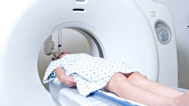 La tomografía permite observar la inflamación y la falta de dopamina en la. sustancia negra, la parte del cerebro que, al dañarse, provoca enfermedad