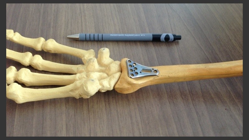 Dentro de la gran diversidad de biomateriales, todos deben tener una característica en común: la biocompatibilidad. 