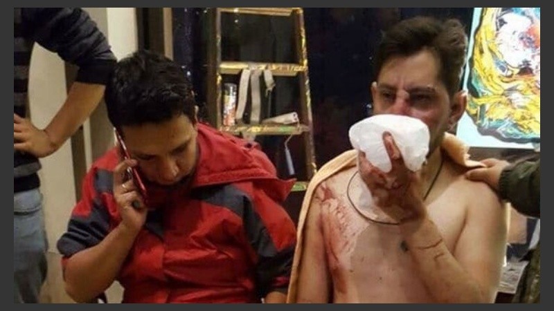 Las imágenes de los hinchas bolivianos tras recibir el ataque.