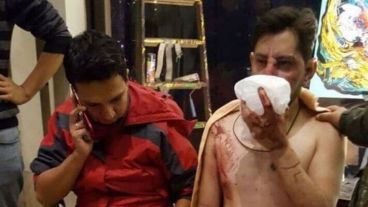 Las imágenes de los hinchas bolivianos tras recibir el ataque.