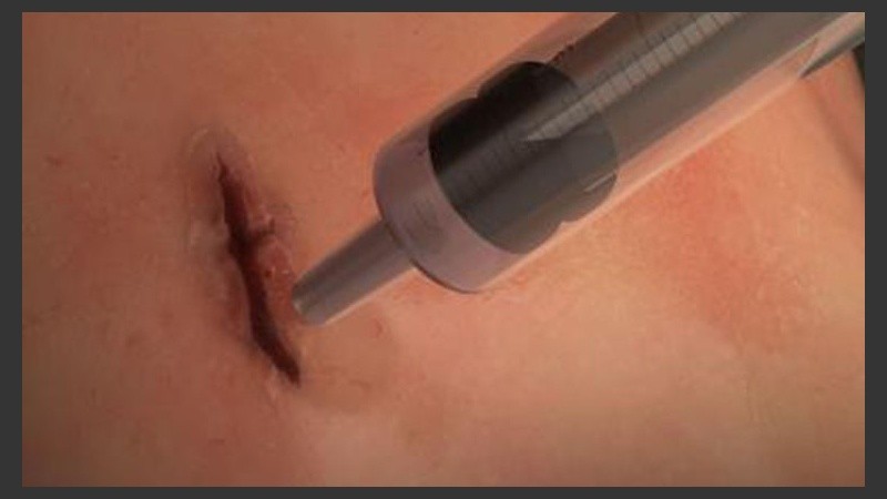 Por el momento MeTro se ha probado en animales con muy buen resultado.