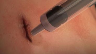 Por el momento MeTro se ha probado en animales con muy buen resultado.