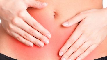 Cuando produce quistes o acúmulos, la endometriosis puede ser detectada rápidamente.