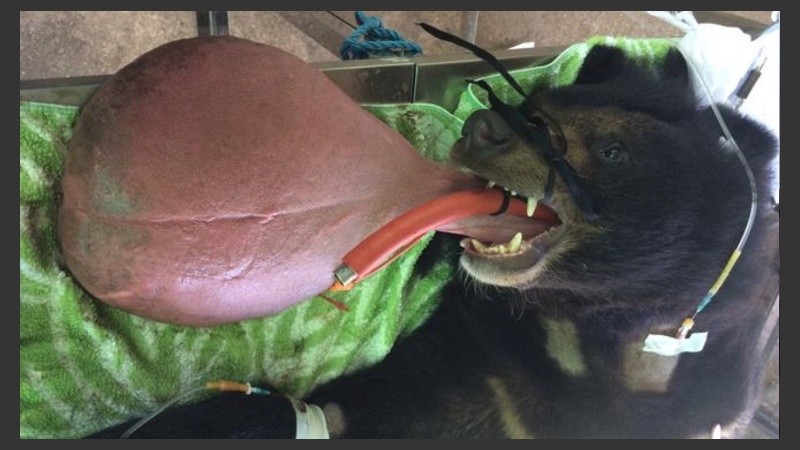 Cirujanos le extirparon parte de la lengua a Nyan htoo. 