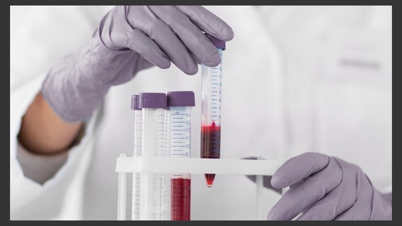 Las transfusiones directas todavía se practicaban a comienzos del siglo XX porque era imposible conservar la sangre extraída inalterada para su posterior uso.