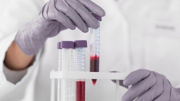 Las transfusiones directas todavía se practicaban a comienzos del siglo XX porque era imposible conservar la sangre extraída inalterada para su posterior uso.