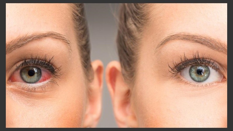 El diagnóstico de glaucoma se hace en una consulta preventiva o en una consulta de control.