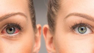 El diagnóstico de glaucoma se hace en una consulta preventiva o en una consulta de control.