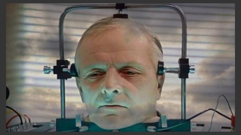 En la operación, el receptor podría ser enfriado hasta un estado de hipotermia profunda para proteger su vida.