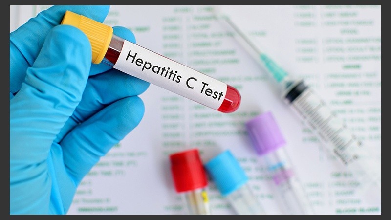 La afección puede ser muy leve o requerir la hospitalización.