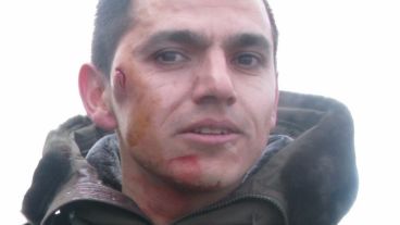 Echazú es el gendarme que declaró haber recibido un piedrazo durante el operativo en la ruta 40.