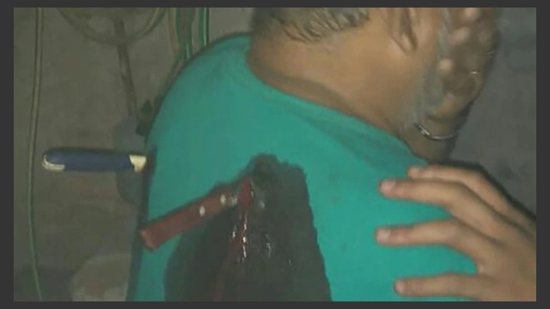 Al llegar, la policía halló al hombre herido, con dos cuchillos clavados en su espalda