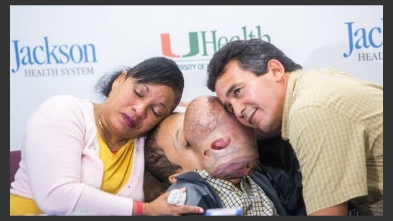 Emanuel había nacido con una displasia fibrosa poliostótica.