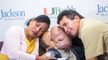 Emanuel había nacido con una displasia fibrosa poliostótica.