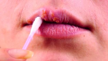 Haber tenido 5 parejas sexuales diferentes aumenta el riesgo de contagio en las mujeres.