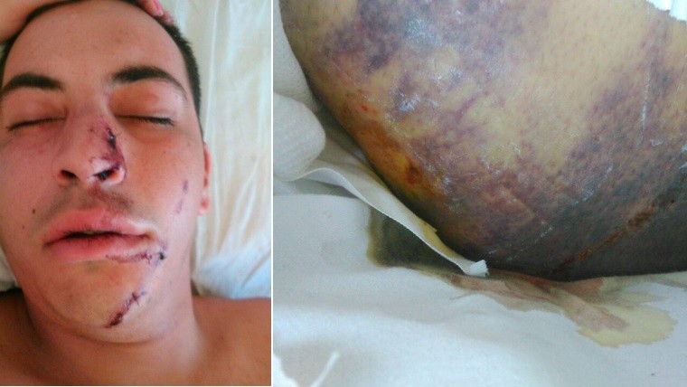 Algunas de las series heridas que sufrió el joven motociclista. 