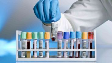 Franco Allegrini es becario del CONICET.