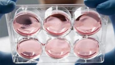 Aquellos en el grupo de trasplante experimentaron una reducción en la discapacidad.