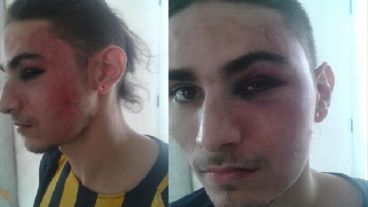 Según la denuncia, los policías hasta le cortaron las rastas.