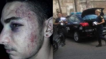 Las marcas de los golpes a Sasha y los dos agentes detenidos.