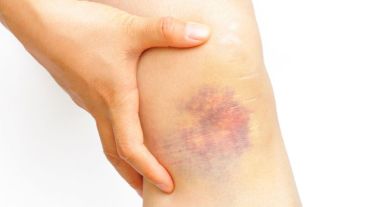 La droga mostró una eficacia del 40% en ratones tratados.