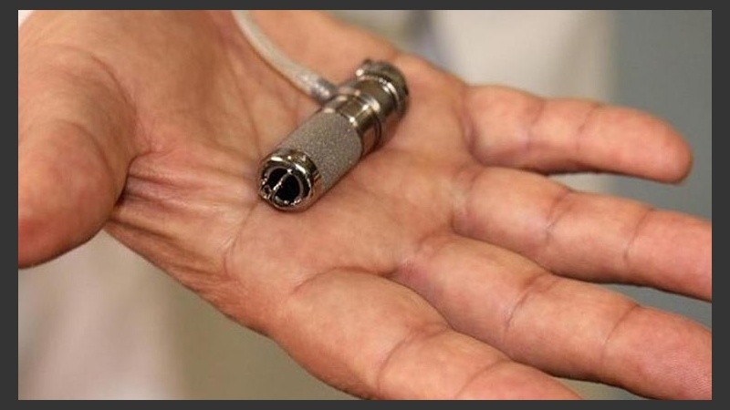 Se trata de la segunda intervención en el mundo de implante de minicorazón después de otra realizada en 2012.