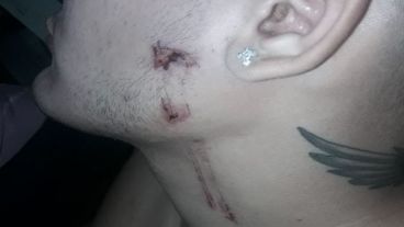 Uno de los detenidos afirmó que fue golpeado con una itaca en su rostro.