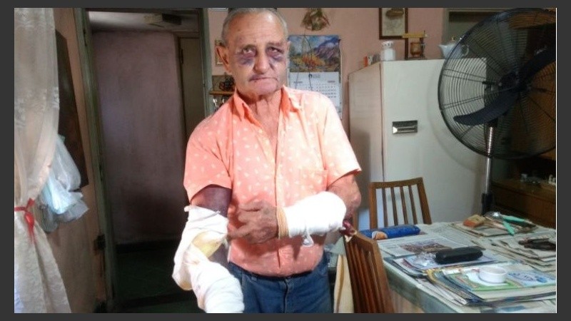 La víctima tiene 74 años. 