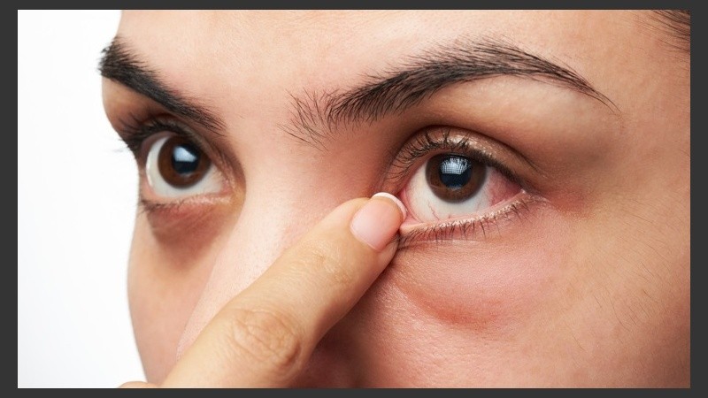 El ojo seco es un trastorno que afecta a 14 millones de argentinos.