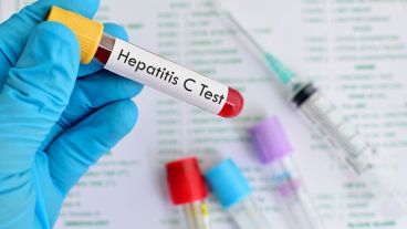 Se calcula que 7 de cada 10 argentinos nunca se realizó la prueba.