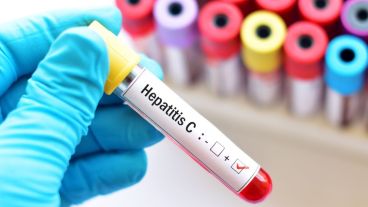 Se estima que en el país cerca de 400 mil personas viven con hepatitis C.